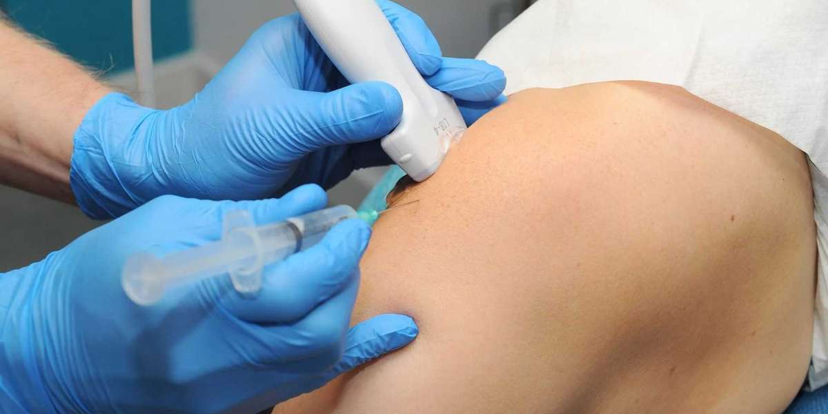 The Cost and Benefits of Ultrasound-Guided Cortisone Injections